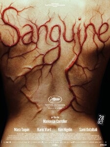 Sanguine